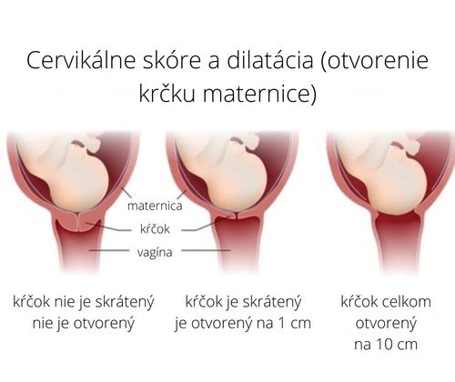 Krčok maternice v tehotenstve a pred pôrodom
